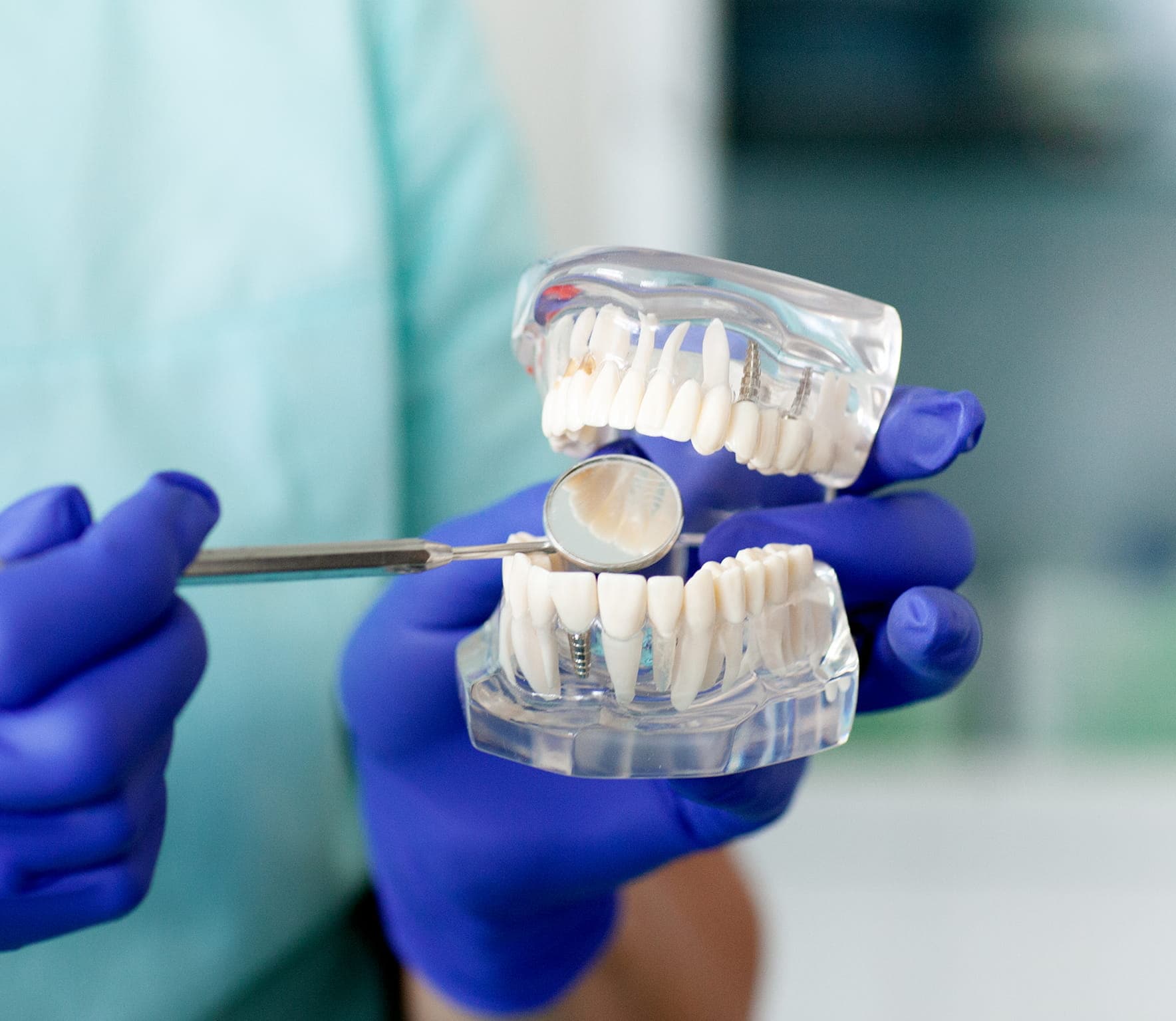 implant 1